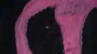 النافورة مثليه ربط الحذاء ليموزين